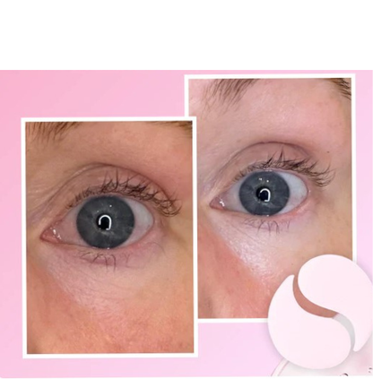 Instalift-Ögonpatches